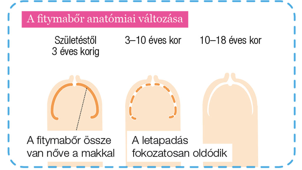 A pénisz vészjósló elváltozásai